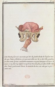 Diagramma sezionale di un bambino estratto dall
