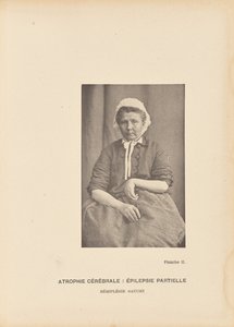Atrofia cerebrale: epilessia parziale Emiplegia sinistra da Paul Marie Léon Regnard