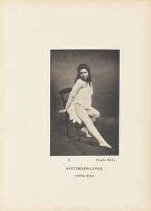 Contrazione istero-epilettica