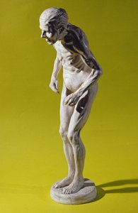 Figura di donna con malattia di Parkinson da Paul Marie Louis Pierre Richer