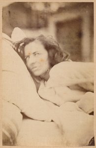 Epilepsia isterica, delirio, lussuria, tavola XXXVI da 
