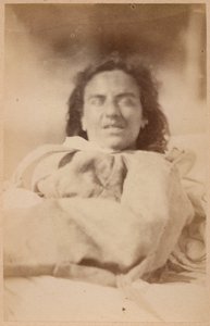 Epilepsia isterica, allucinazioni, ironia, tavola XXXII da 