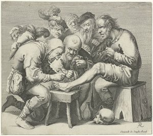 Operazione al piede da Pieter Jansz Quast
