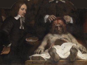 La lezione di anatomia del dottor Jan Deyman, 1656 da Rembrandt van Rijn