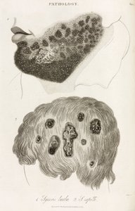 Dermatologia Malattie della pelle da John Pardon
