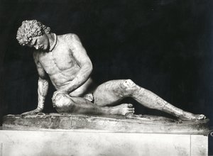 Galata morente, copia di un originale greco del c.230-220 a.C. di Epigonos