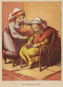 Il bambino deforme
