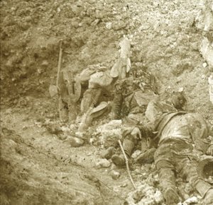Corpo di soldato morto, c1914-c1918