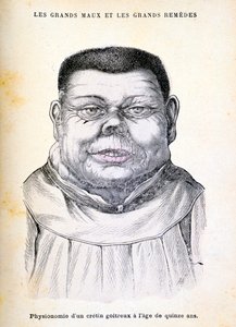 Cretino di 15 anni, c1890