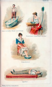 Trattamenti di idroterapia, c1902 da Unbekannt