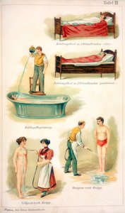 Trattamenti idroterapici, c1902 da Unbekannt