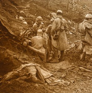Les Éparges, Francia settentrionale, 1915