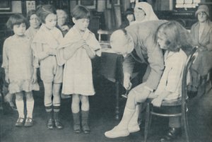 Test del riflesso rotuleo per indicazione di malattia nervosa, c1935