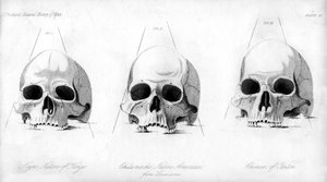 Tre tipi di cranio umano da Unbekannt