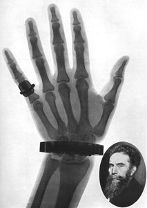 Radiografia di una mano, 1926