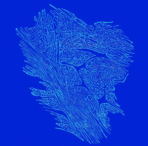Sezione trasversale di tumori fibro-nucleati da Unbekannter Künstler