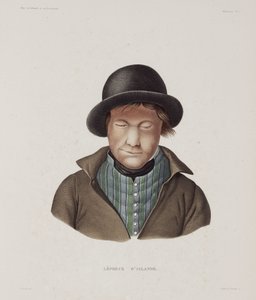 Malattie, lebbra: lebbroso maschio, Islanda, inizio XIX secolo