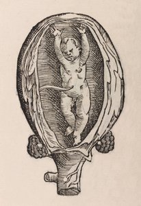 Partus non naturalis manibus funra canut porrectie da Unbekannt