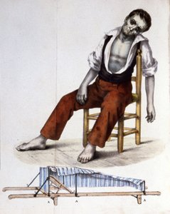 Paziente con colera da Unbekannter Künstler