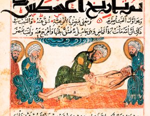 Rappresentazione di un parto cesareo. Miniatura tratta da un manoscritto di medicina di Abu Raihan Al-Biruni (o Alberuni) (973-1048), intellettuale e scienziato persiano, folio 161. da Unbekannt