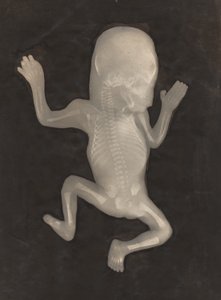 Grado di ossificazione di un feto di cinque mesi di età da Unknown