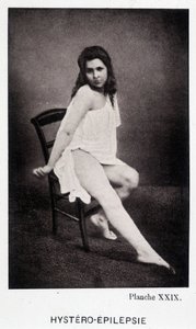 Hystero Epilepsie - Contrattura in "Iconografia fotografica della Salpêtrière: servizio del Sig. Charcot" di Paul Regnard e Bourneville da Unknown artist