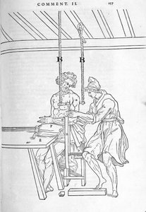 Riduzione delle fratture. Tavola illustrata di "De dissectione partium corporis humani libri tres..." di Carlo Stefano Riverio, Parigi 1545 da Unknown artist
