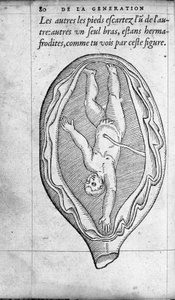 La posizione del feto nell