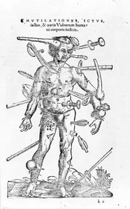 Tutti i tipi di ferite traumatiche di guerra. XVI secolo da Unknown artist