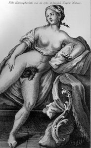Ragazza ermafrodita vista nel 1751 e disegnata dal vivo da Unknown artist