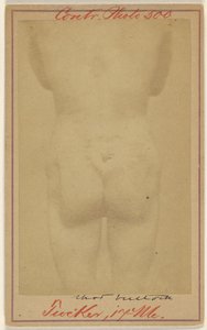 [Jno. E. Tucker, colpito da una pallottola nelle natiche, vittima della guerra civile].
