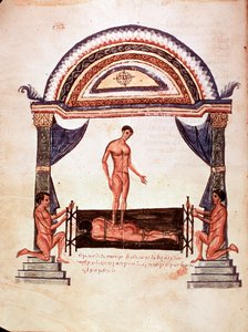 Medicina: riduzione di una colonna vertebrale lussata - il paziente è fissato su una tavola di legno, uno dei terapeuti sta sulla sua schiena (manoscritto) da Unknown artist