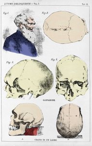 Studio sulla morfologia di un cranio delinquente da parte del criminologo italiano da Unknown artist