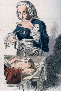 La trapanazione. Stampa del XVIII secolo da Unknown artist