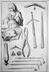 Trepanazione del cranio, vari strumenti da Unknown artist