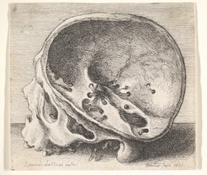 Teschio sezionato in profilo a sinistra con il lato sinistro del cranio rimosso, 1651 da Wenceslaus Hollar