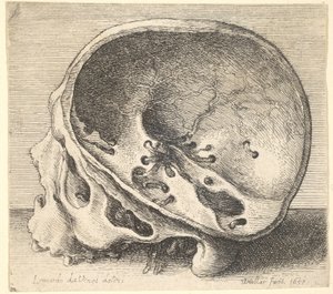 Teschio sezionato in profilo a sinistra con il lato sinistro del cranio rimosso, 1651 da Wenceslaus Hollar