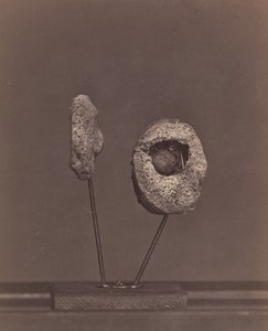 Articolazione del ginocchio escissa. Una palla di moschetto rotonda nel condilo interno del femore destro da William H. Bell