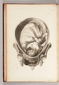 Incisione di un bambino nel grembo materno da "Una serie di tavole anatomiche, con spiegazioni e un compendio della pratica dell