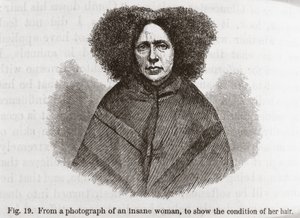 Psichiatria Donna pazza da Frederick (attr. to) Barnard