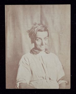 Ritratto psichiatrico di un paziente, Surrey County Asylum, c. 1852 da John Pardon