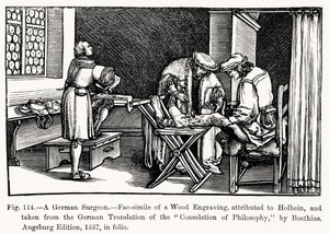 Un chirurgo tedesco, da Consolation of Philosophy di Boethius, illustrazione da Science and Literature in the Middle Ages and Renaissance, scritto e inciso da Paul Lacroix, 1878 da after German School