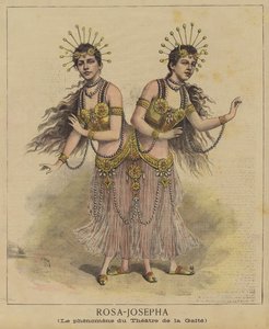 Gemelli siamesi