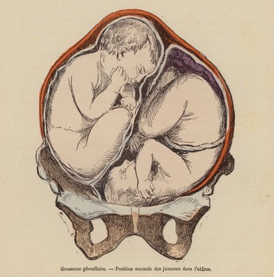 Posizione normale dei gemelli nell