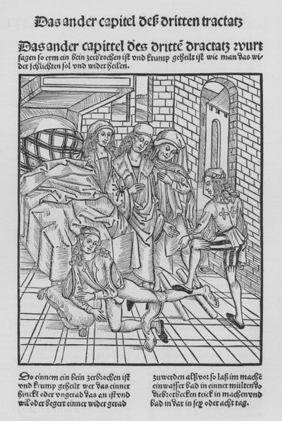 Il libro di Cirurgia di Hieronymus Brunschwig da (after) German School