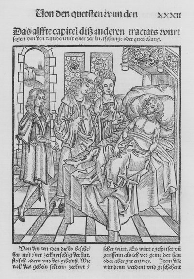 Il libro di Cirurgia di Hieronymus Brunschwig da (after) German School