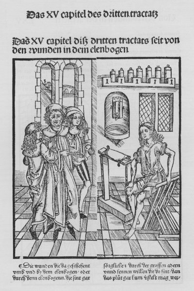 Il libro di Cirurgia di Hieronymus Brunschwig (litografia) da (after) German School