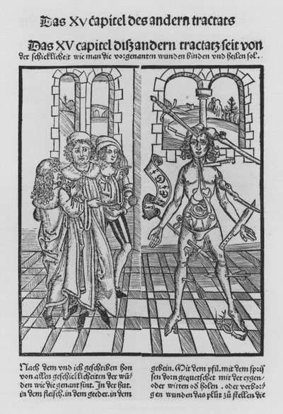 Il libro di Cirurgia di Hieronymus Brunschwig da (after) German School