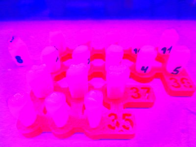 Denti neon da Martina Konitzky