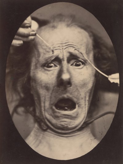 Elettro-fisiologia, Figura 64 da Adrien Alban Tournachon
